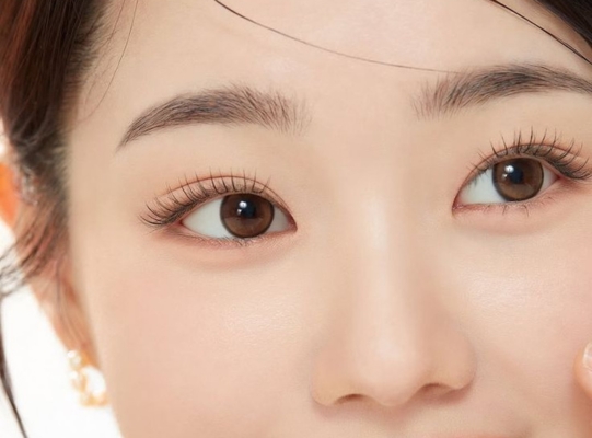 Cắt mí ILID tại Viện thẩm mỹ La Ratio