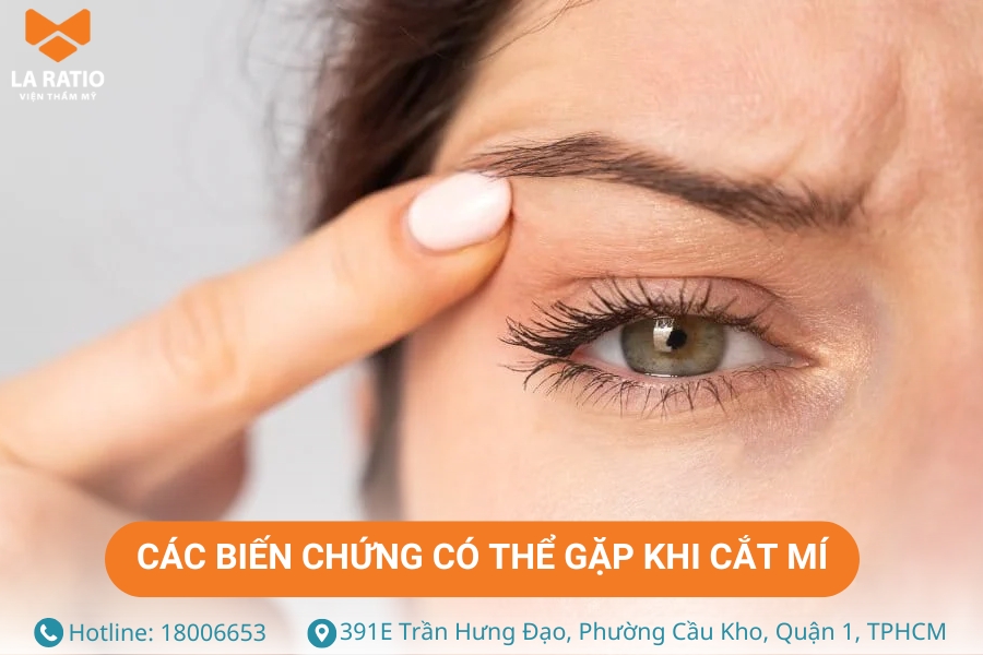 Những biến chứng về mắt có thể gặp khi cắt mí mắt