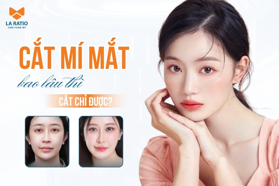Cắt mí mắt bao lâu thì cắt chỉ? Một số lưu ý để rút ngắn thời gian cắt chỉ Cắt mí mắt bao lâu thì cắt chỉ? Một số lưu ý để rút ngắn thời gian cắt chỉ