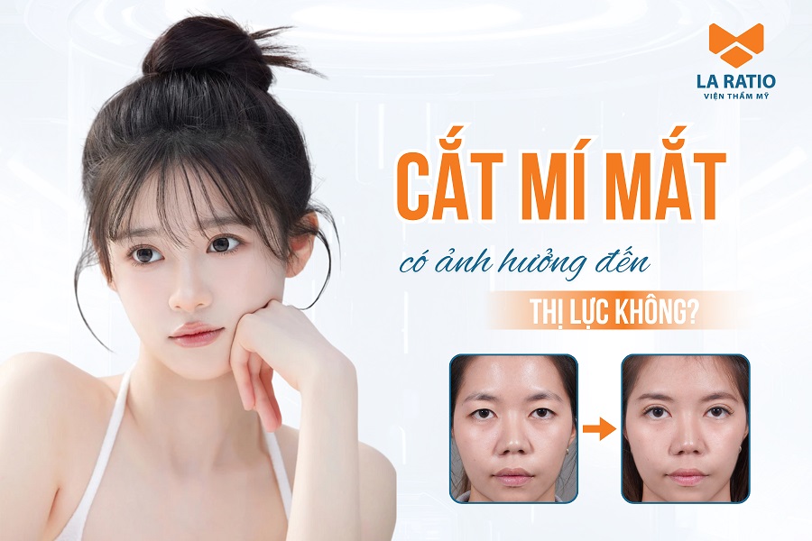 Cắt mí mắt có ảnh hưởng đến thị lực không? Một số lưu ý cần biết