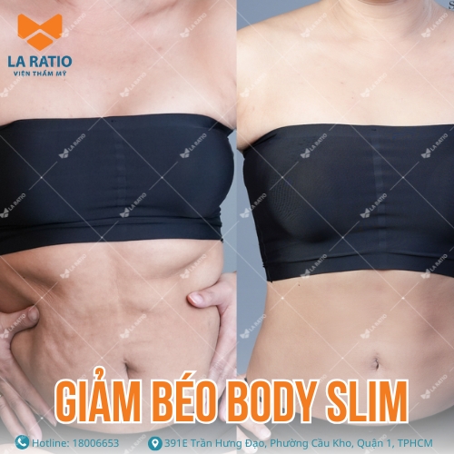 hình ảnh khách hàng trước và sau khi giảm béo body slim tại la ratio