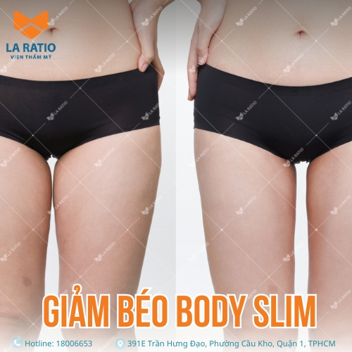hình trước và sau khi giảm béo body slim tại viện thẩm mỹ la ratio