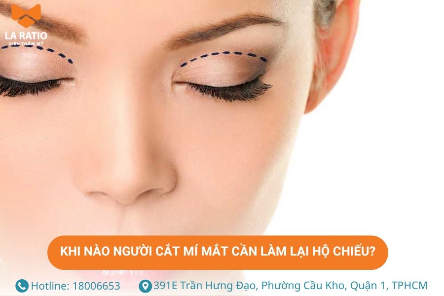 Người cắt mí cần làm lại hộ chiếu khi gương mặt thay đổi quá nhiều sau phẫu thuật