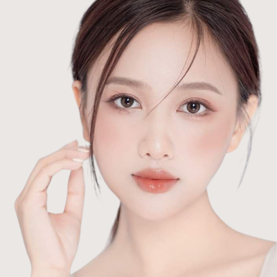 lấy mỡ góc mắt la ratio