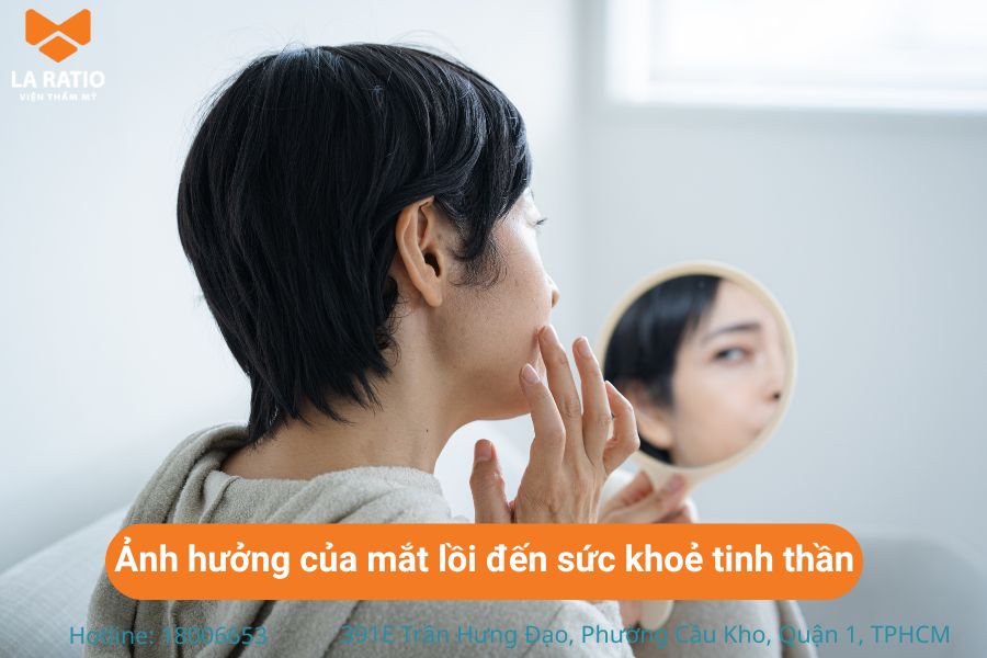 Người bị mắt lồi dễ cảm thấy căng thẳng, tự ti