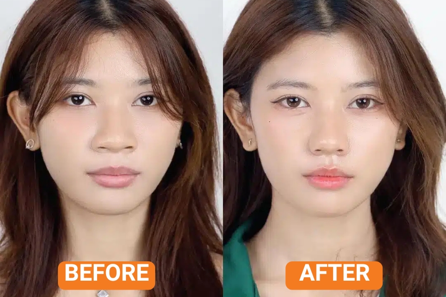 Cắt cánh mũi giúp thu gọn cánh mũi cà chua to bè