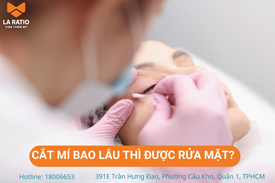 Cắt mí bao lâu thì được rửa mặt? Thông thường là từ khoảng 1-2 tuần Cắt mí bao lâu thì được rửa mặt? Thông thường là từ khoảng 1-2 tuần