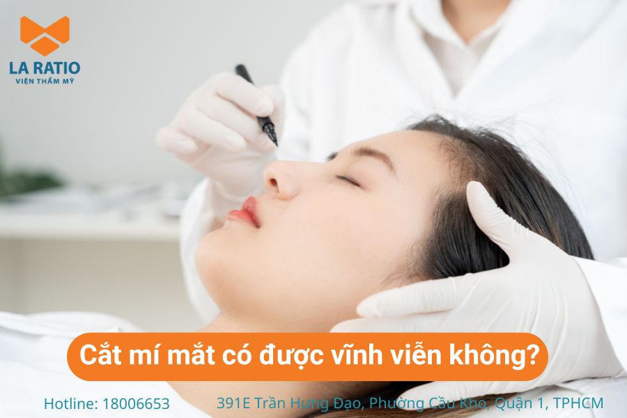 Cắt mí mắt có được vĩnh viễn không? Bác sĩ Võ Thành Trung giải đáp là “không”