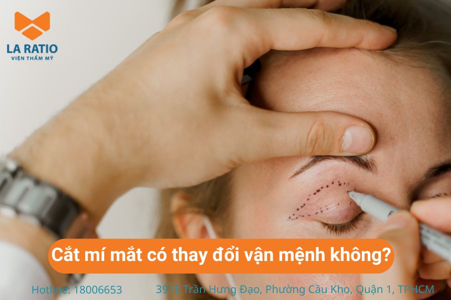 Chưa có bằng chứng nào cho thấy cắt mắt có thể ảnh hưởng đến vận mệnh