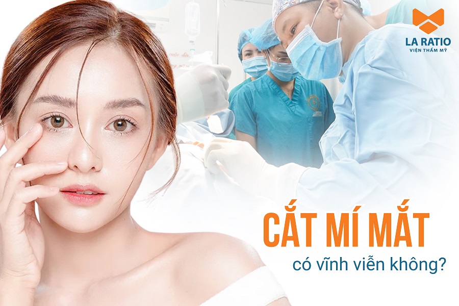 Cắt mí mắt có được vĩnh viễn không? Duy trì được bao lâu?