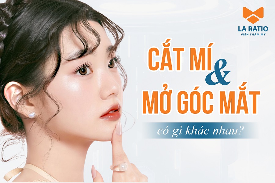 Cắt mí và mở góc mắt có gì khác nhau? Nên chọn kỹ thuật nào?