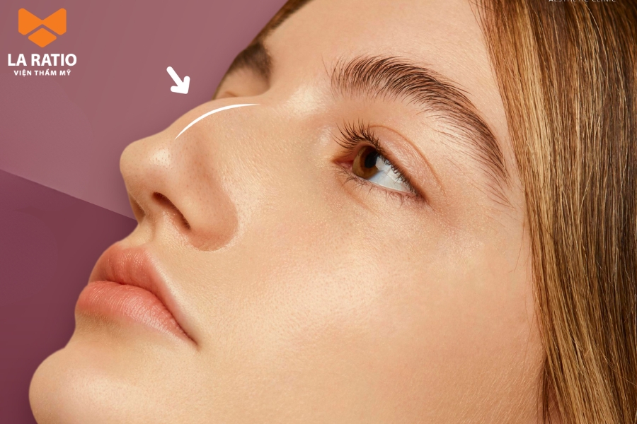 Mũi nhòm mồm là dáng mũi xấu trong cả góc nhìn thẩm mỹ lẫn nhân tướng học Mũi nhòm mồm là dáng mũi xấu trong cả góc nhìn thẩm mỹ lẫn nhân tướng học