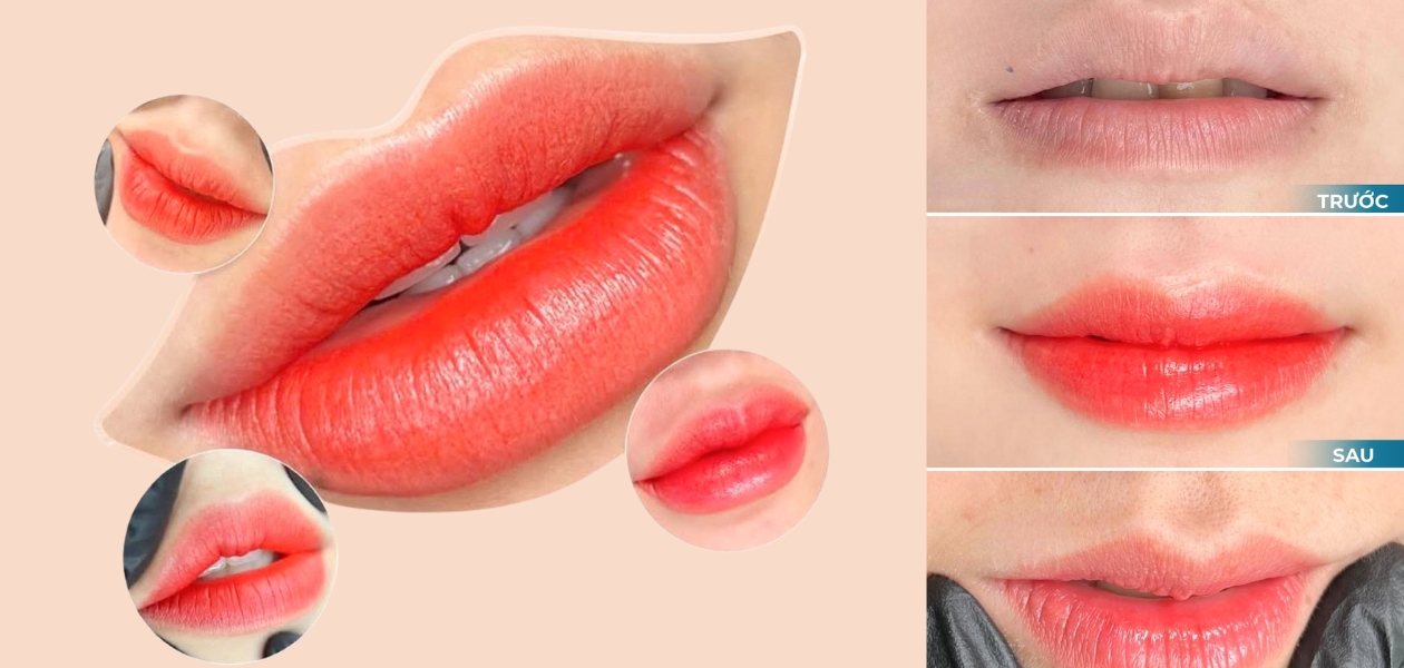 Phun môi Roise Lady