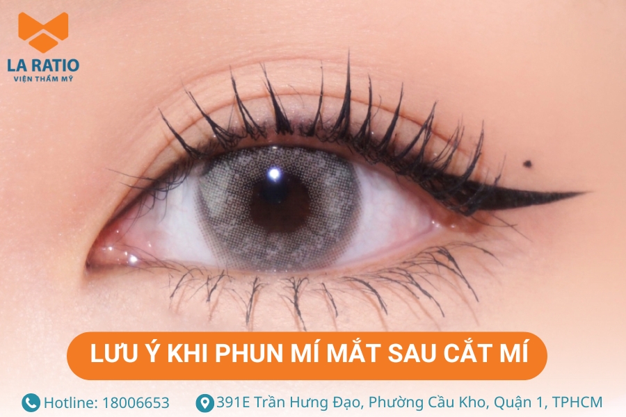 Chỉ nên phun mí khi có sự đồng ý của bác sĩ thẩm mỹ thực hiện cắt mí