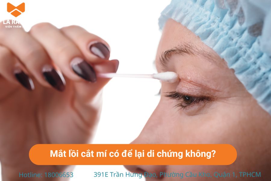 Cắt mí mắt lồi có thể để lại biến chứng nếu bác sĩ không có chuyên môn 