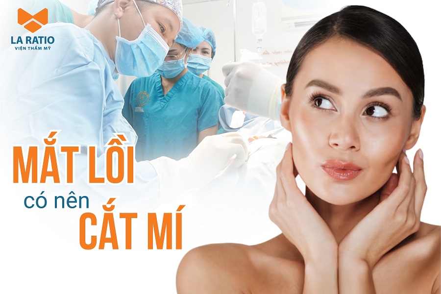 Người mắt lồi có nên cắt mí không? Cần lưu ý gì?