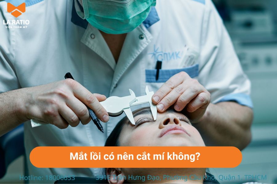 Mắt lồi có nên cắt mí không? Mắt lồi vẫn có thể cắt mí nhưng nên tìm đơn vị uy tín