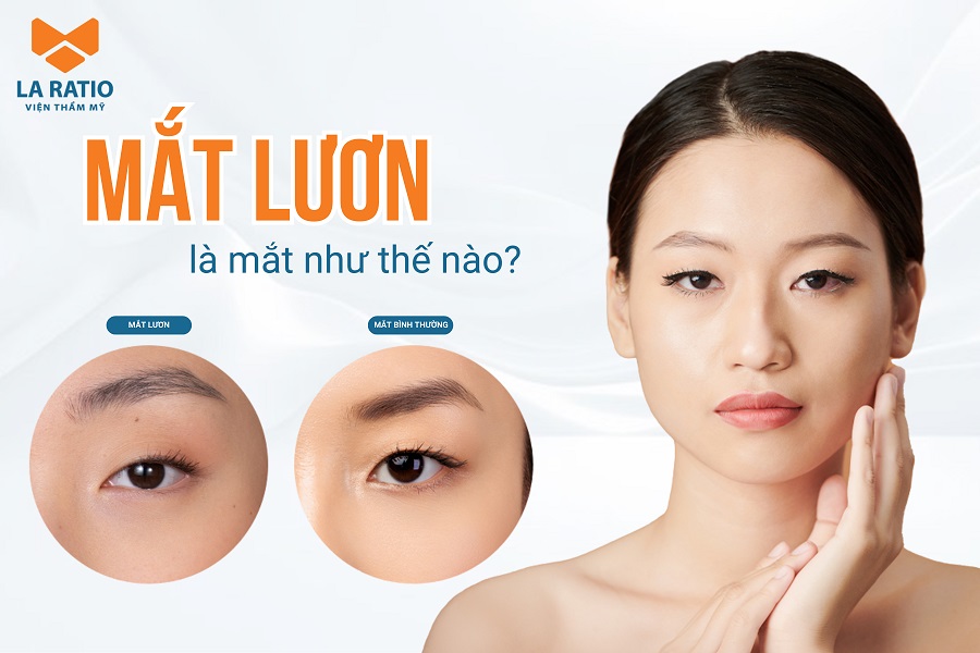 Mắt lươn là gì? Người ti hí mắt lươn là người như thế nào?