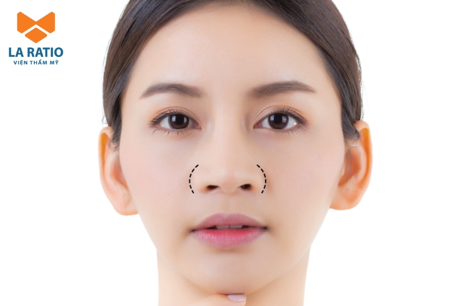 Mũi đỏ cà chua không phải là dáng mũi đẹp theo tiêu chuẩn