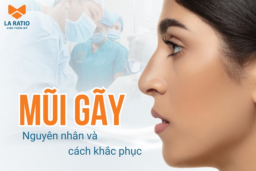 Mũi gãy là thế nào? Nguyên nhân và cách khắc phục sống mũi bị gãy