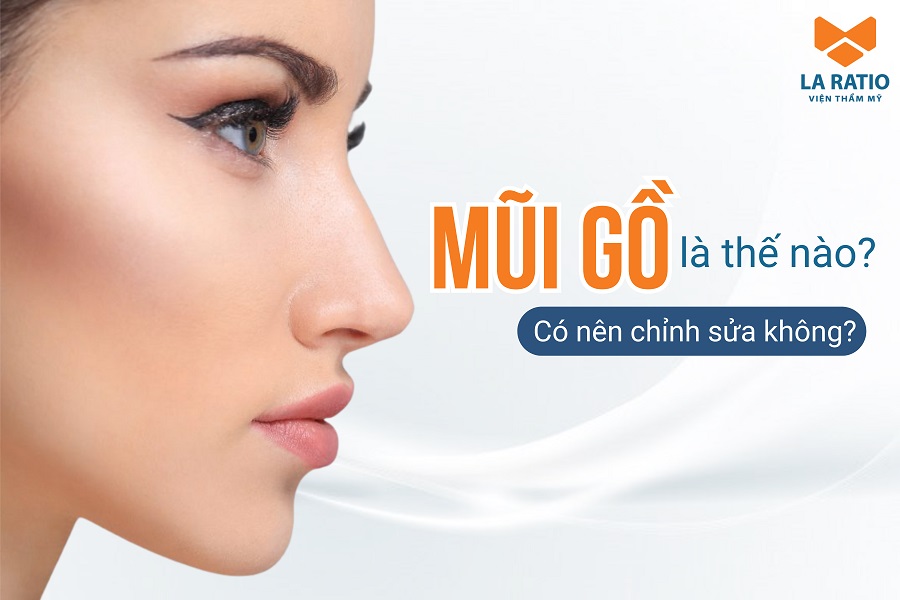 Mũi gồ là như thế nào? Đẹp hay xấu? Có thể chỉnh sửa được không?