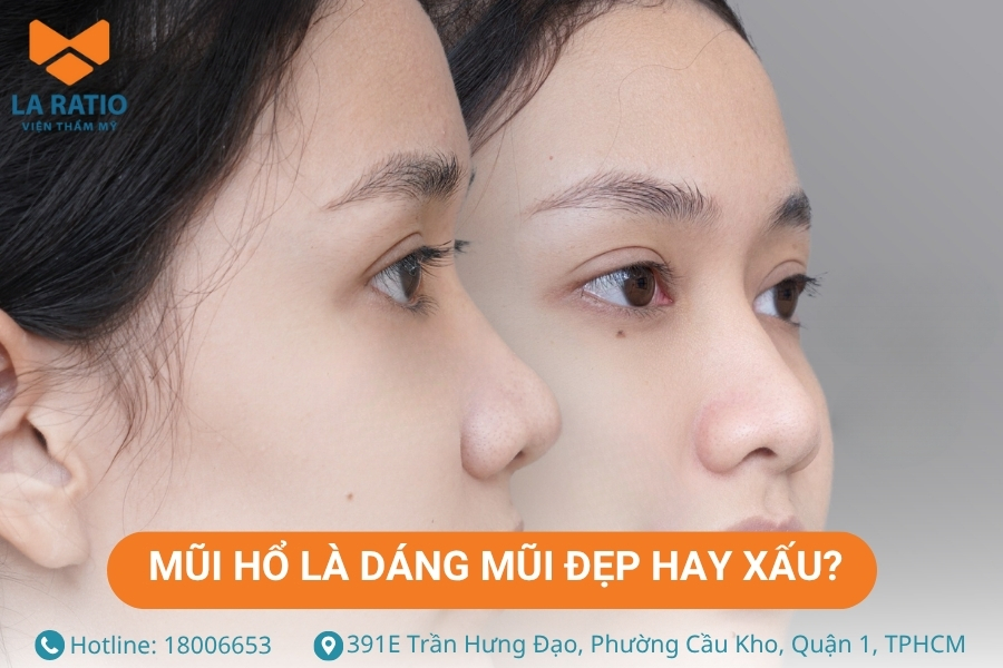 Mũi hổ đẹp hay xấu còn tùy thuộc vào sự hài hòa với các đường nét khác trên gương mặt Mũi hổ đẹp hay xấu còn tùy thuộc vào sự hài hòa với các đường nét khác trên gương mặt