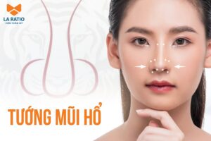 Mũi hổ là dáng mũi như thế nào? Có nên chỉnh sửa không?
