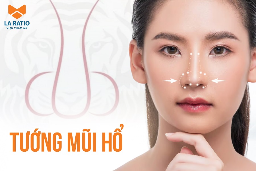 Mũi hổ là dáng mũi như thế nào? Có nên chỉnh sửa không? Mũi hổ là dáng mũi như thế nào? Có nên chỉnh sửa không?