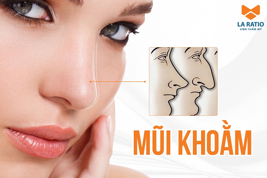 Mũi khoằm là gì? Người mũi khoằm có vận số tốt hay xấu?
