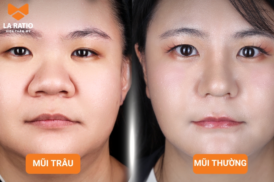 Mũi trâu có kích thước đầy đặn, chiếm phần lớn diện tích trên gương mặt