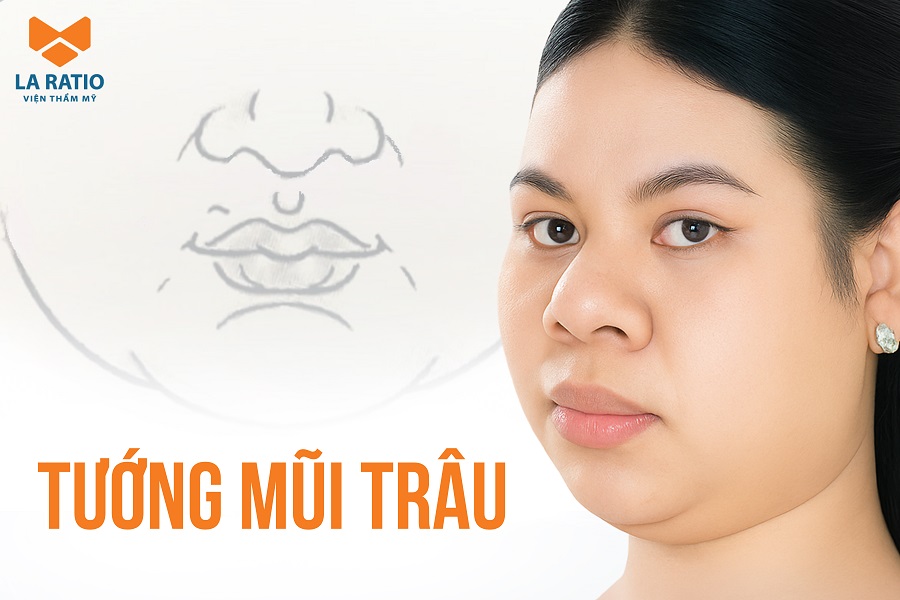 Mũi trâu là gì? Xem tướng mũi trâu ở nam, nữ tốt hay xấu?