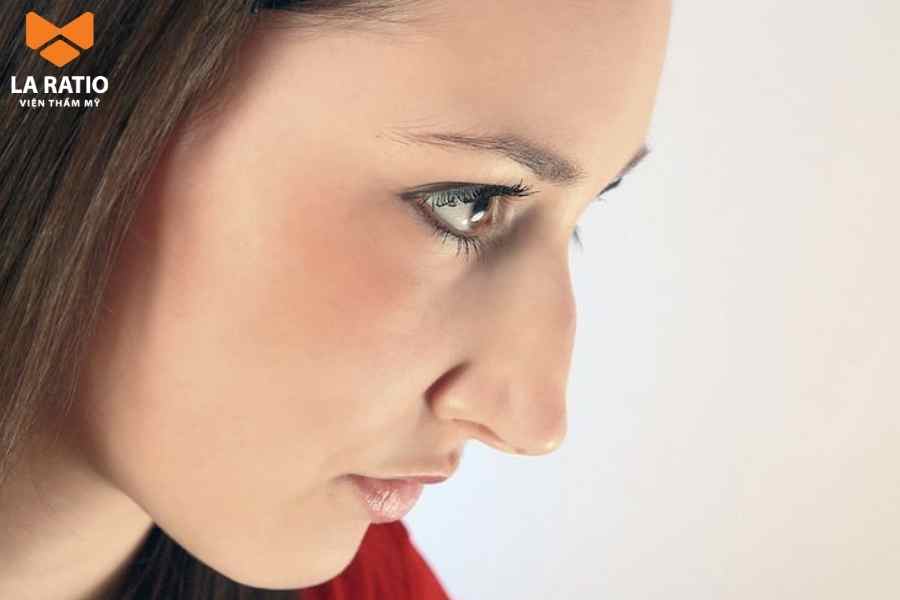 Sống mũi bị gồ có thể do di truyền hoặc do di chứng của chấn thương để lại