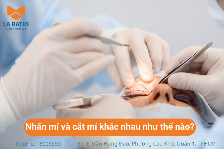 Nhấn mí và cắt mí mắt khác nhau về kỹ thuật thời gian duy trì hiệu quả Nhấn mí và cắt mí mắt khác nhau về kỹ thuật thời gian duy trì hiệu quả