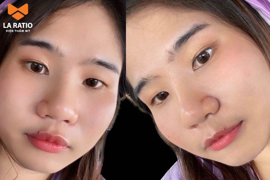 Nữ mũi cà chua - Sống chân thành, bao dung nhưng tình duyên lận đận