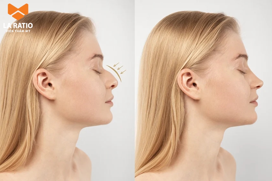 Phụ nữ mũi diều hâu - Dù kiếm tiền giỏi nhưng lại ít giữ được của