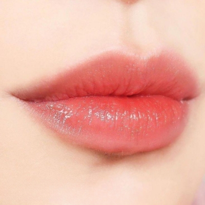 phun môi collagen la ratio