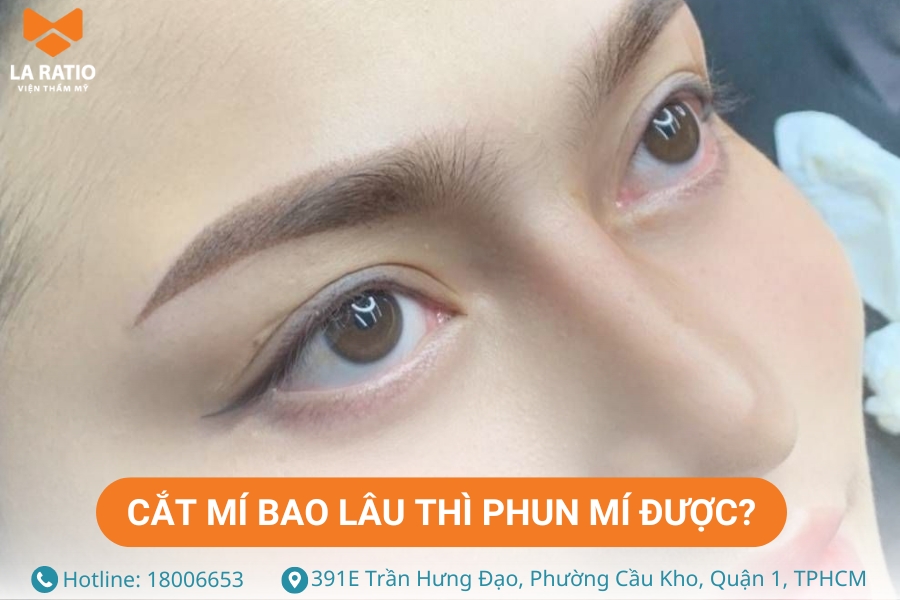 Cắt mí bao thì phun mí được còn tùy thuộc vào tốc độ hồi phục của từng khách hàng Cắt mí bao thì phun mí được còn tùy thuộc vào tốc độ hồi phục của từng khách hàng