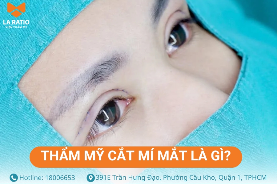 Cắt mí là tiểu phẫu thẩm mỹ giúp đôi mắt trông to tròn và có chiều sâu hơn Cắt mí là tiểu phẫu thẩm mỹ giúp đôi mắt trông to tròn và có chiều sâu hơn
