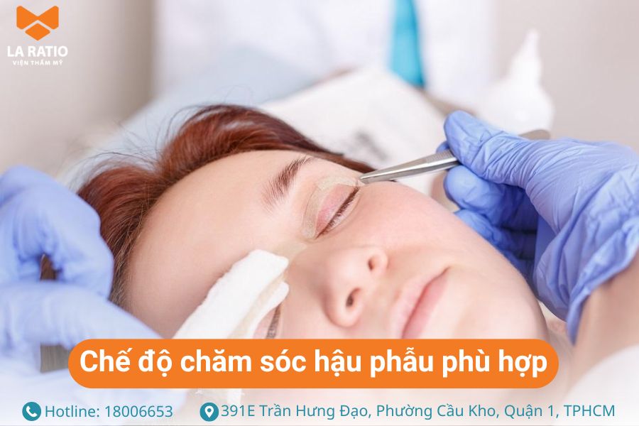 Chế độ chăm sóc hậu phẫu phù hợp sẽ giúp duy trì nếp mí lâu hơn
