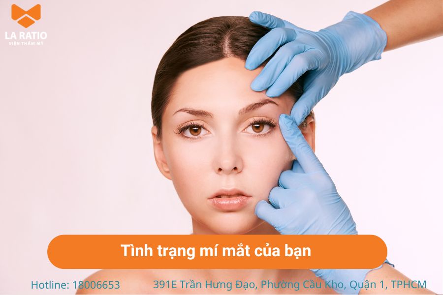 Nên xem xét tình trạng hiện tại của mí mắt trước khi quyết định cắt mí Nên xem xét tình trạng hiện tại của mí mắt trước khi quyết định cắt mí