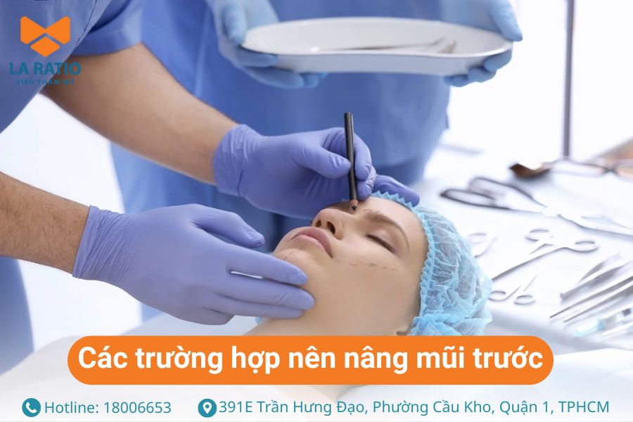 Các trường hợp nên nâng mũi trước khi cắt mắt