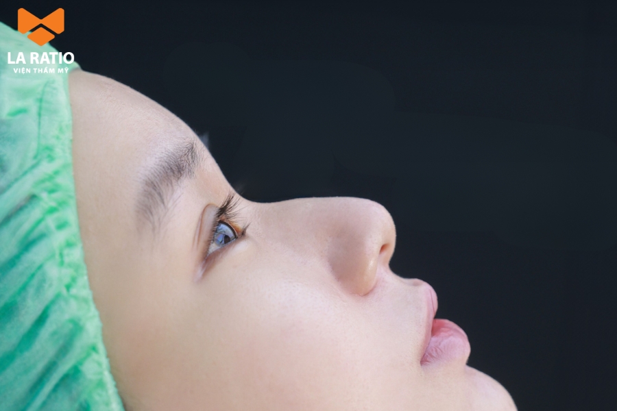 Tướng mũi gãy nữ