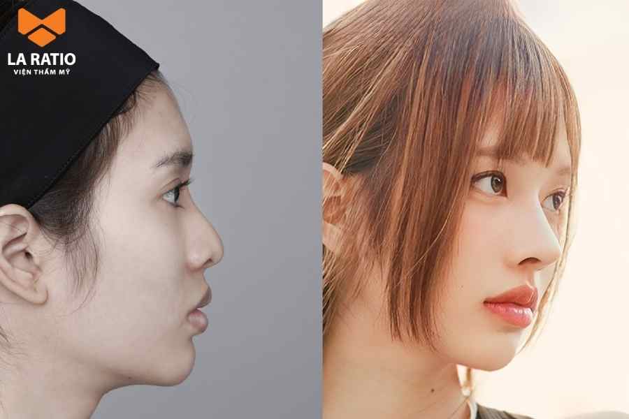 Mũi gồ phong thuỷ ở nữ - Giỏi nhưng tài vận không tốt, phải trải qua nhiều thử thách