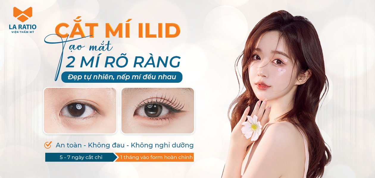 cắt mí mắt ilid tại viện thẩm mỹ la ratio
