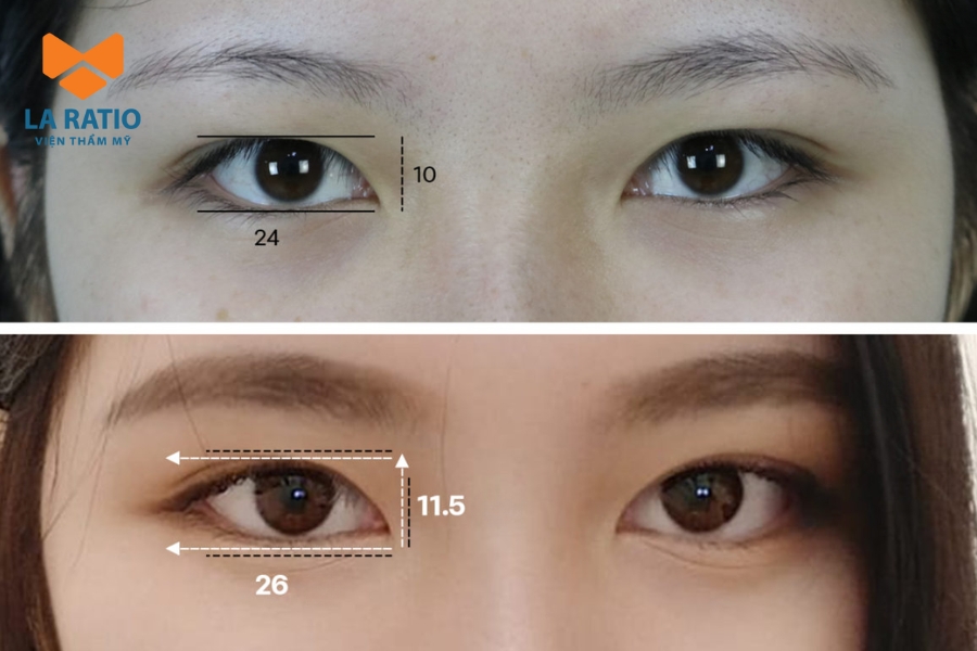 Mở rộng góc mắt giúp đôi mắt chó sói hiền hòa và cân đối hơn