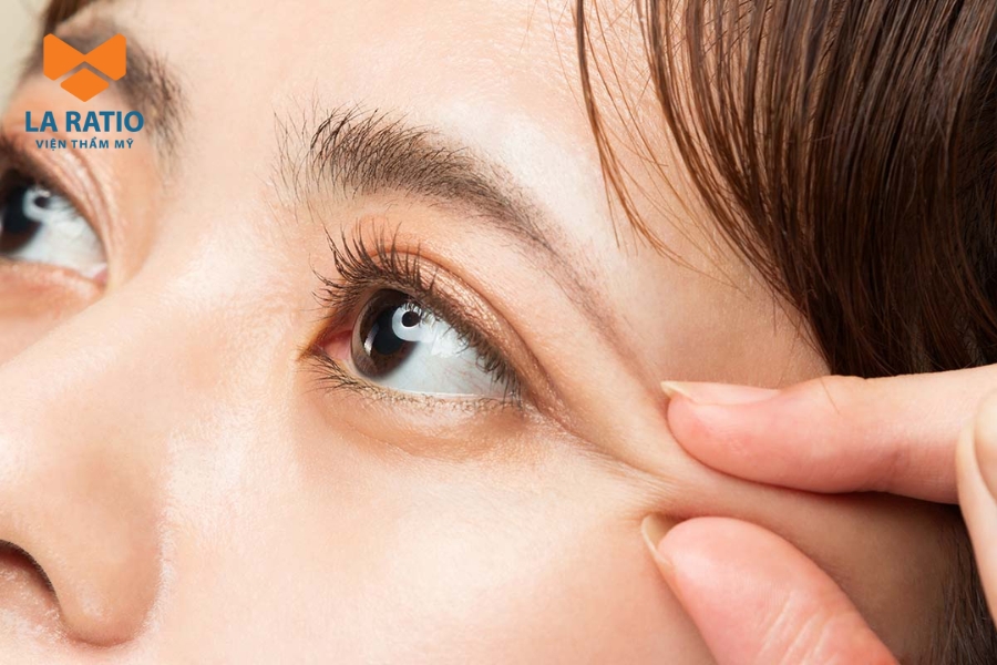 Nếu cảm thấy mắt voi chưa hài hòa, bạn có thể cân nhắc can thiệp chỉnh sửa