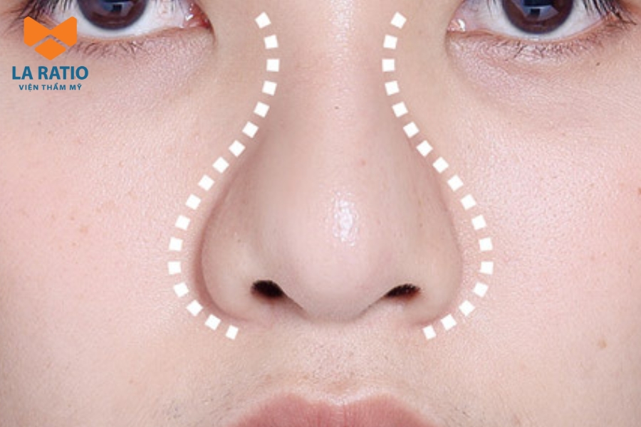 Mũi củ tỏi là biểu tượng cho năng lực giữ tiền của chủ sở hữu