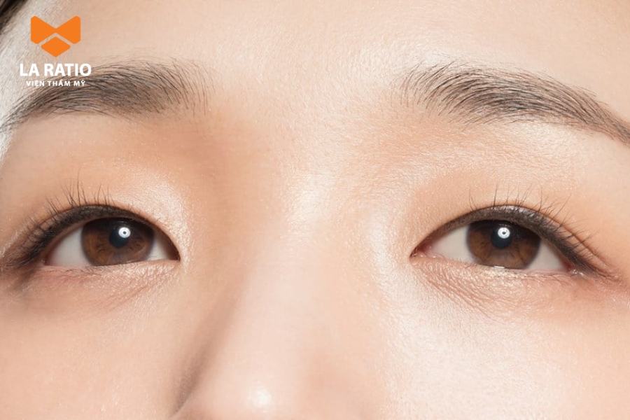 Mắt dê không phải là dáng mắt đẹp theo tiêu chuẩn thẩm mỹ