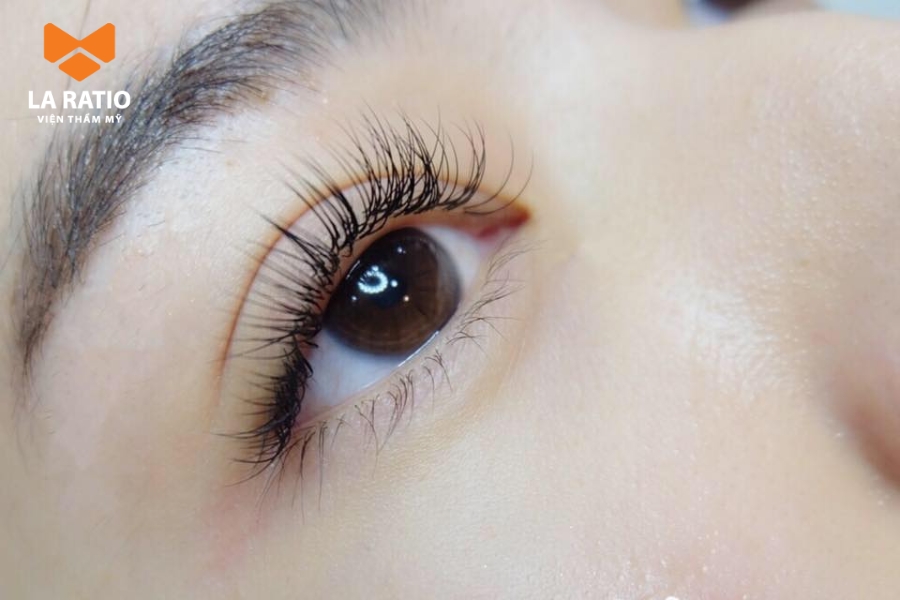 Đôi mắt ướt át có thể gây ảnh hưởng đến thị lực Đôi mắt ướt át có thể gây ảnh hưởng đến thị lực