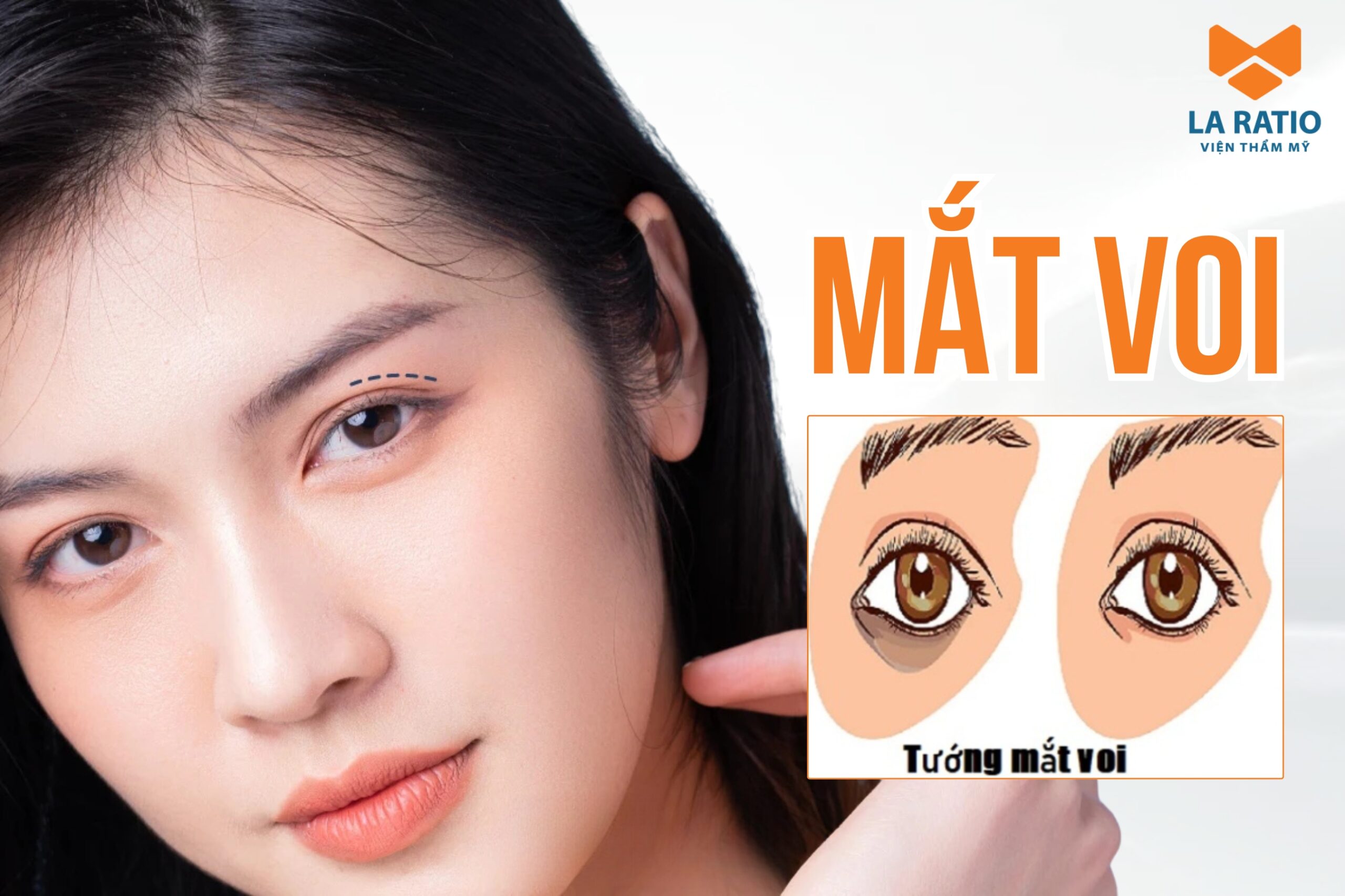 Mắt voi là dáng mắt như thế nào? Ý nghĩa tướng số tốt hay xấu?
